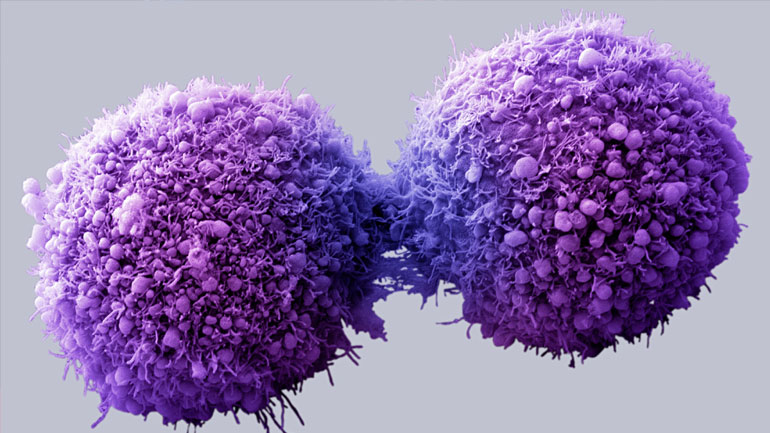 Ανακαλύφθηκε πρωτεΐνη που ενισχύει την ανοσία στον καρκίνο